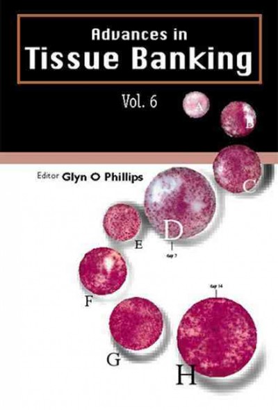 Advances in tissue banking. Vol. 6 [electronic resource] / editor-in-chief Glyn O Phillips  ; contributing editor, J Sanchez Ibanez ; regional editors A Nather, D M Strong, R von Versen.
